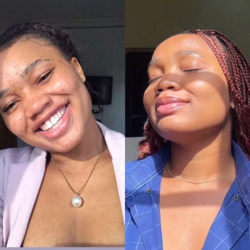 𝐂𝐀𝐑𝐑𝐎𝐓 𝐀𝐒𝐂𝐎𝐑𝐁𝐈𝐂 𝐀𝐂𝐈𝐃 𝐂𝐑𝐄𝐀𝐌.