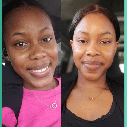 𝐂𝐀𝐑𝐑𝐎𝐓 𝐀𝐒𝐂𝐎𝐑𝐁𝐈𝐂 𝐀𝐂𝐈𝐃 𝐂𝐑𝐄𝐀𝐌.